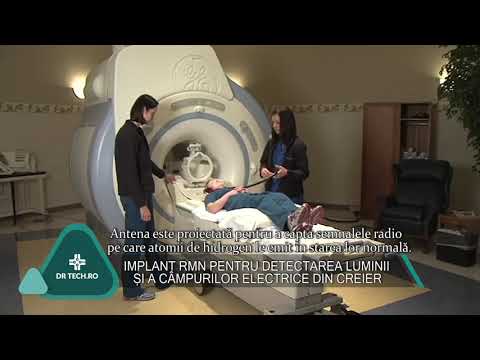 Implant RMN pentru detectarea luminii și a câmpurilor electrice din creier - DrTech.ro