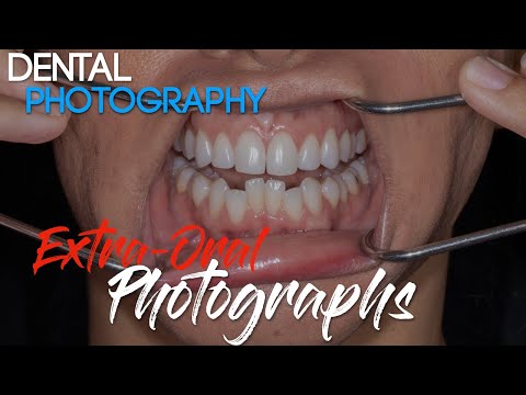 Dental Photography Basics - Dental Photography Techniques - Extra-oral Photographs