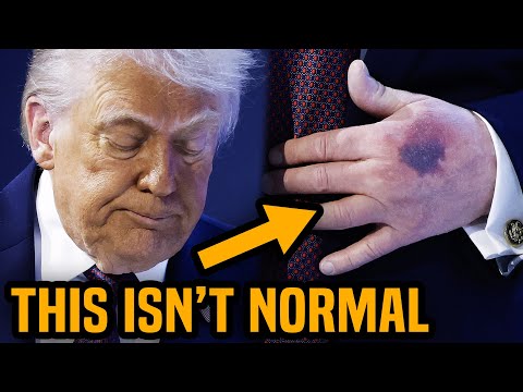 Trump’s health crisis just got really weird