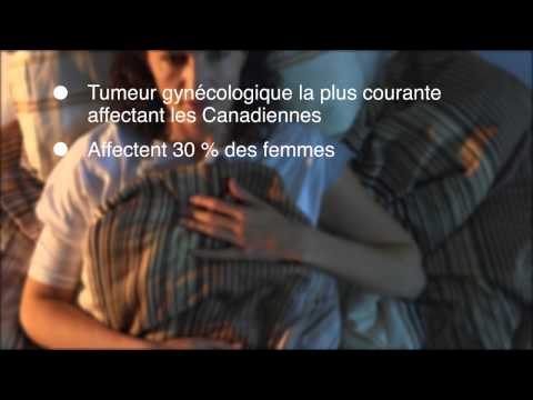 comment traiter fibrome