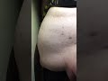 Slight Water Bloat Part 2