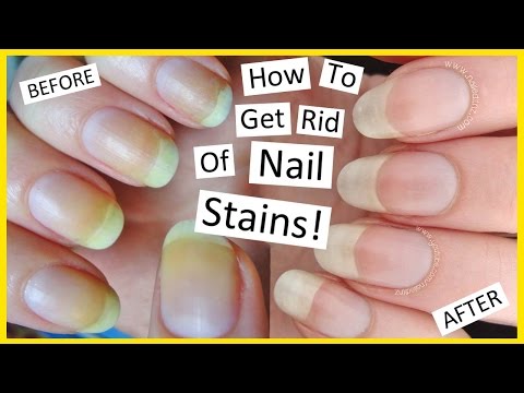 image-Can nails be stained?
