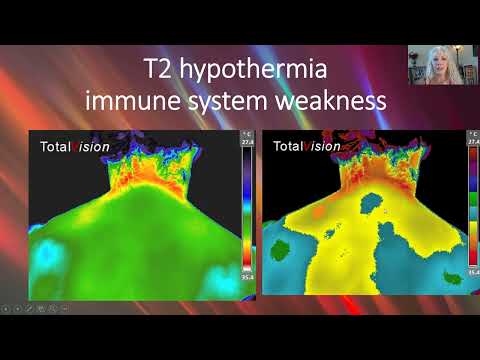Medical Thermography