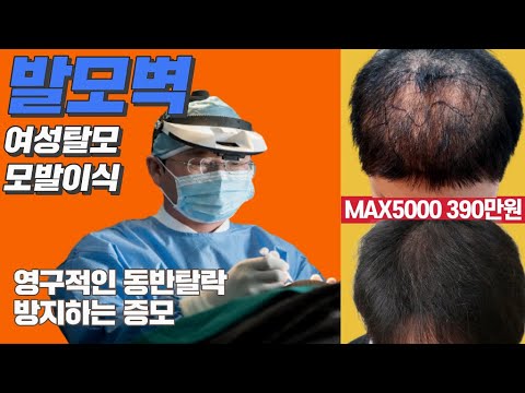 발모벽 여성탈모 모발이식 영구적인 동반탈락을 방지하는 모발 사이 모발이식이 중요합니다.