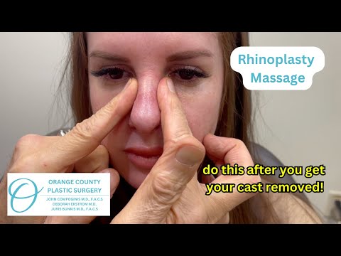 Rhinoplasty Massage After Cast Removal #rhinoplastysurgeon #rhinoplastyspecialist #nosejob