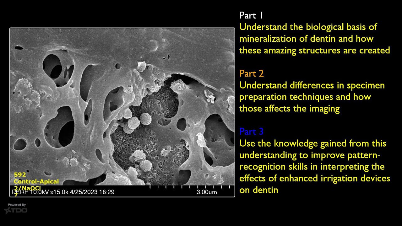 SEM Imaging: Biomineralization: Part 1