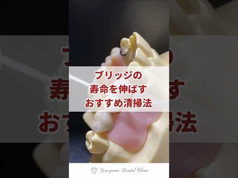 ブリッジの寿命を伸ばすスーパーフロス #ブリッジ #フロス #虫歯予防 #歯周病予防 #歯医者 #徳島歯医者
