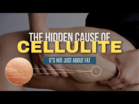 Understanding what causes Cellulite: the Fascia, Alignment, and Lymph Connection