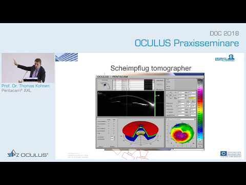 Prof. Dr. Thomas Kohnen: Pentacam® AXL