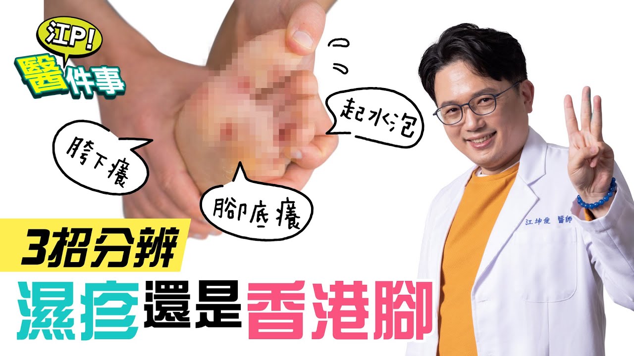 夏季好發香港腳!醫授3招和濕疹區別 擦錯藥當心更嚴重