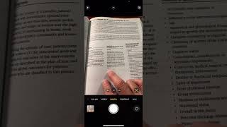 Training an AI Scribe for Physical Therapy Documentation