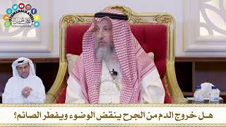 665 - هل خروج الدم من الجرح ينقض الوضوء ويفطّر الصائم؟ - عثمان الخميس