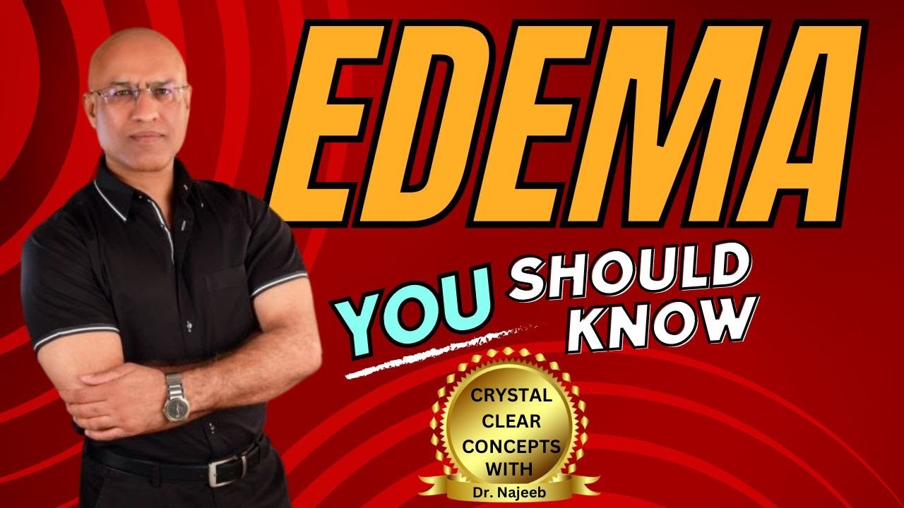 Edema | Types Causes and Symptoms👨‍⚕️
