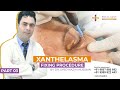 Effective Treatment of Xanthelasma by Dr Syed Nazim | Aesthetic & Hair Transplant Surgeon | Delhi