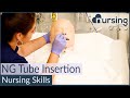 NG Nasogastric Tube Insertion Techniques Nursing Skills