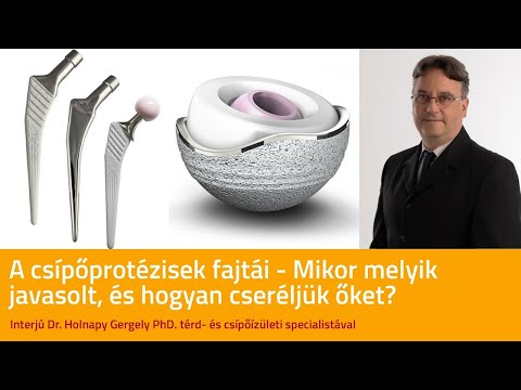 Kinek fordul az ízületi fájdalom