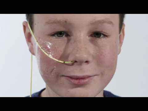 Feeding Tube Education- Placing an NG Tube