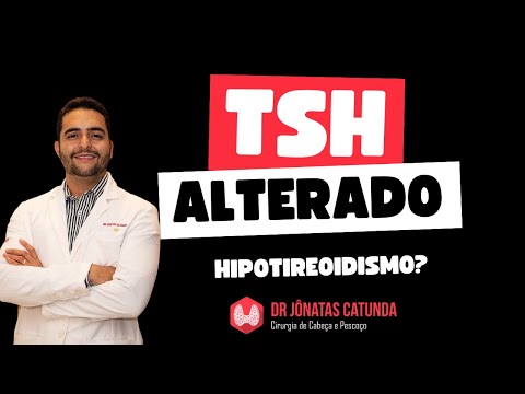 Elevated TSH level - above 50 - Severe Hypothyroidism?