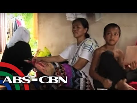 Kung anong bahagi ng katawan ay nagsisimula sa mawalan ng timbang unang Repolyo diyeta para sa pagbaba ng timbang