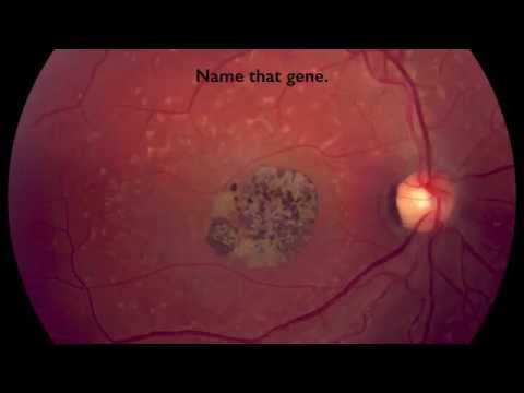 Retina & Vitreous Anatomy 