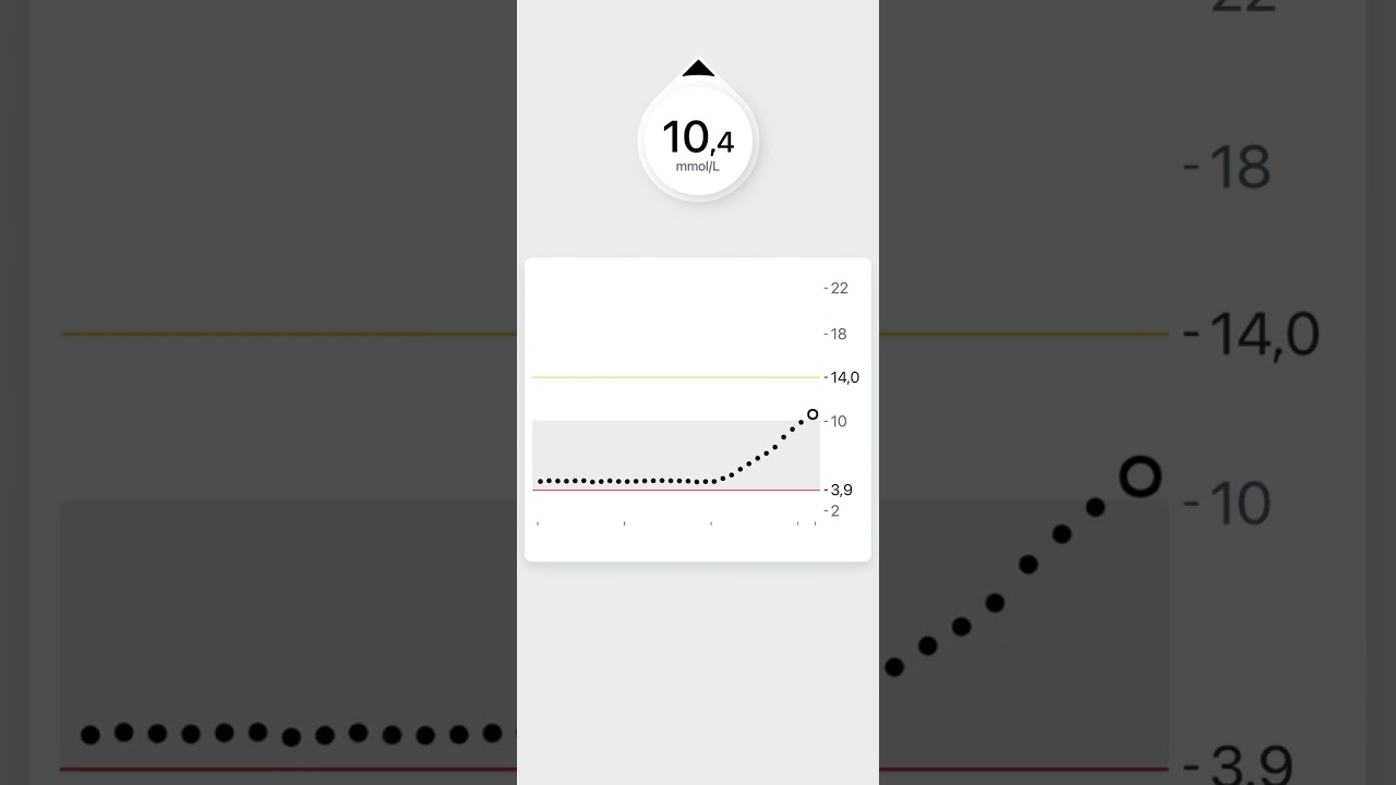 IAV alerts Dexcom ONE+ OUS BG MMOL