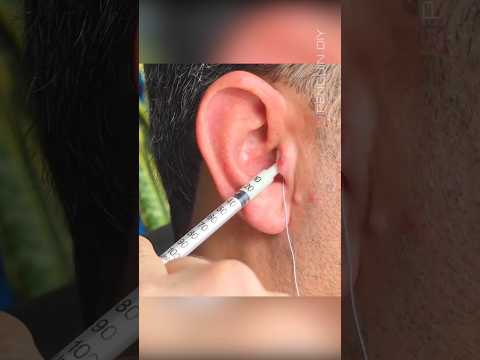 Invisible earphones, built completely from scratch. 🕵️‍♂️🎧