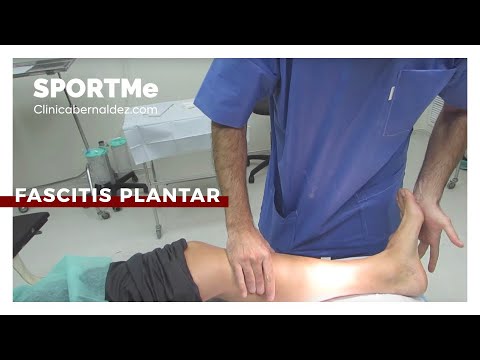 Plantar Fasciitis