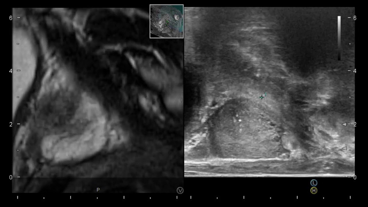 Miguel Angel Rodríguez Cabello-12