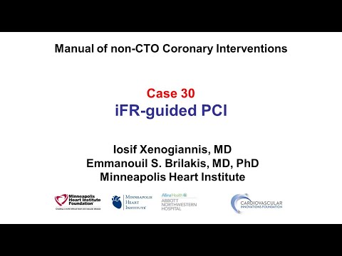 Case 30: PCI Manual - iFR guided PCI
