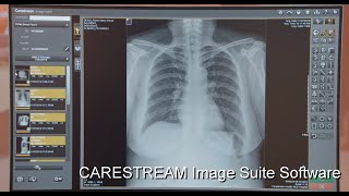 Image Suite Software Streamlines Workflow in Smaller Imaging Facilities