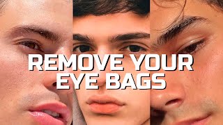 Get Rid of Bags Under Your Eyes Forever (+50% attractiveness)
