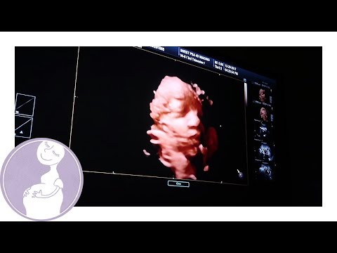 3D-ultraljud! - Rebecca Stella v.34