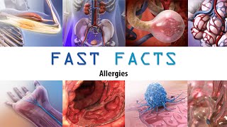 Allergies: Visible Body Fast Facts