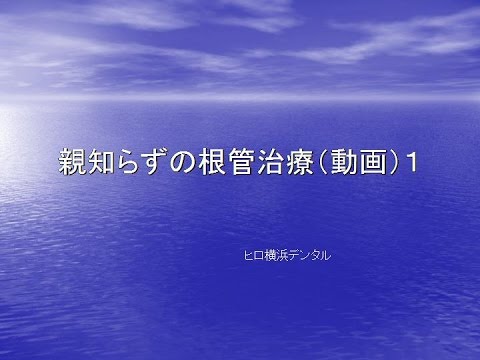 歯学科 ヒロ横浜デンタル　歯の根が割れて抜くことになった箇所に自分の親知らずを移植（No５)