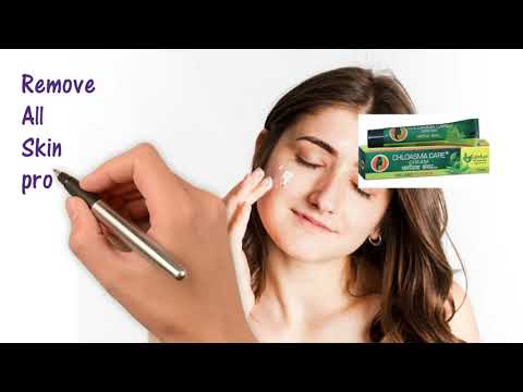 Chloasma Care Cream for melasma related issues