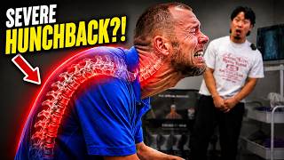 **EXTREME HUNCHBACK** GETS 'FLATTENED!!' 😱 | Asmr Chiropractic Neck & Back Pain | Dr Tubio