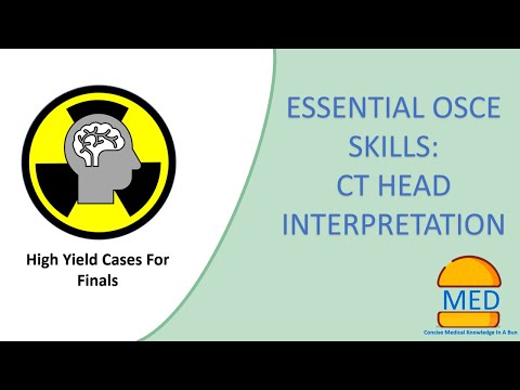 ESSENTIAL OSCE SKILLS: CT HEAD INTERPRETATION with high yield examples