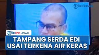 Sidang Lanjutan Kasus Penyiraman Air Keras Andrie Yunus, Rilis Foto Terdakwa Serda Edi Sudarko