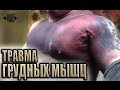 Реабилитация после травмы груди! Ян Цабут 