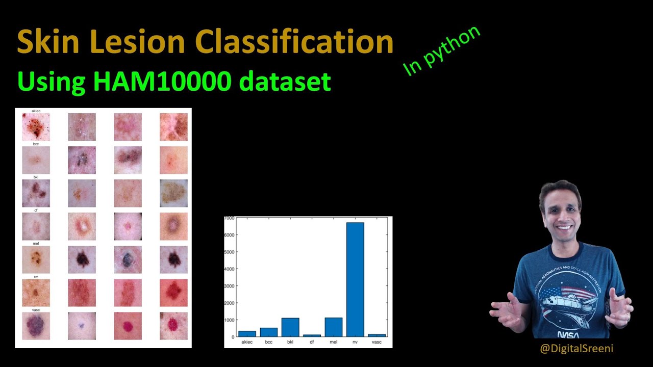 203 - Skin cancer lesion classification using the HAM10000 dataset