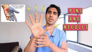 What Causes Pins and Needles in Hand at Night ? (Paresthesia)