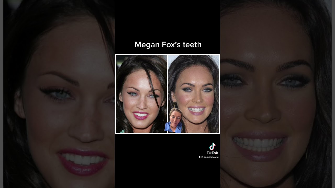 Megan Fox’s teeth #shorts #meganfox