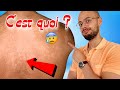 Comment Soigner Ce Problème De Peau