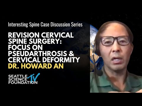Revision Cervical Spine Surgery: Focus on Pseudarthrosis & Cervical Deformity - Howard An, MD