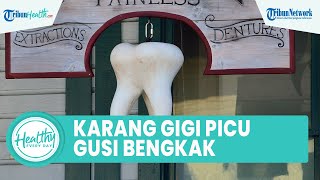Karang Gigi Membandel hingga Memicu Gusi Bengkak Bisa Diatasi dengan Bahan Alami di Rumah