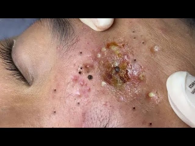 𝑺𝒐𝒐𝒕𝒉𝒊𝒏𝒈 𝑭𝒂𝒄𝒊𝒂𝒍 𝑻𝒓𝒆𝒂𝒕𝒎𝒆𝒏𝒕 𝑭𝒐𝒓 𝑺𝒕𝒓𝒆𝒔𝒔 𝑹𝒆𝒍𝒊𝒆𝒇 𝒂𝒕 𝑳𝒖𝒙𝒖𝒓𝒚 𝑺𝒑𝒂 𝑨𝒄𝒉𝒊𝒆𝒗𝒆 𝑰𝒏𝒏𝒆𝒓 𝑷𝒆𝒂𝒄𝒆 #5001330