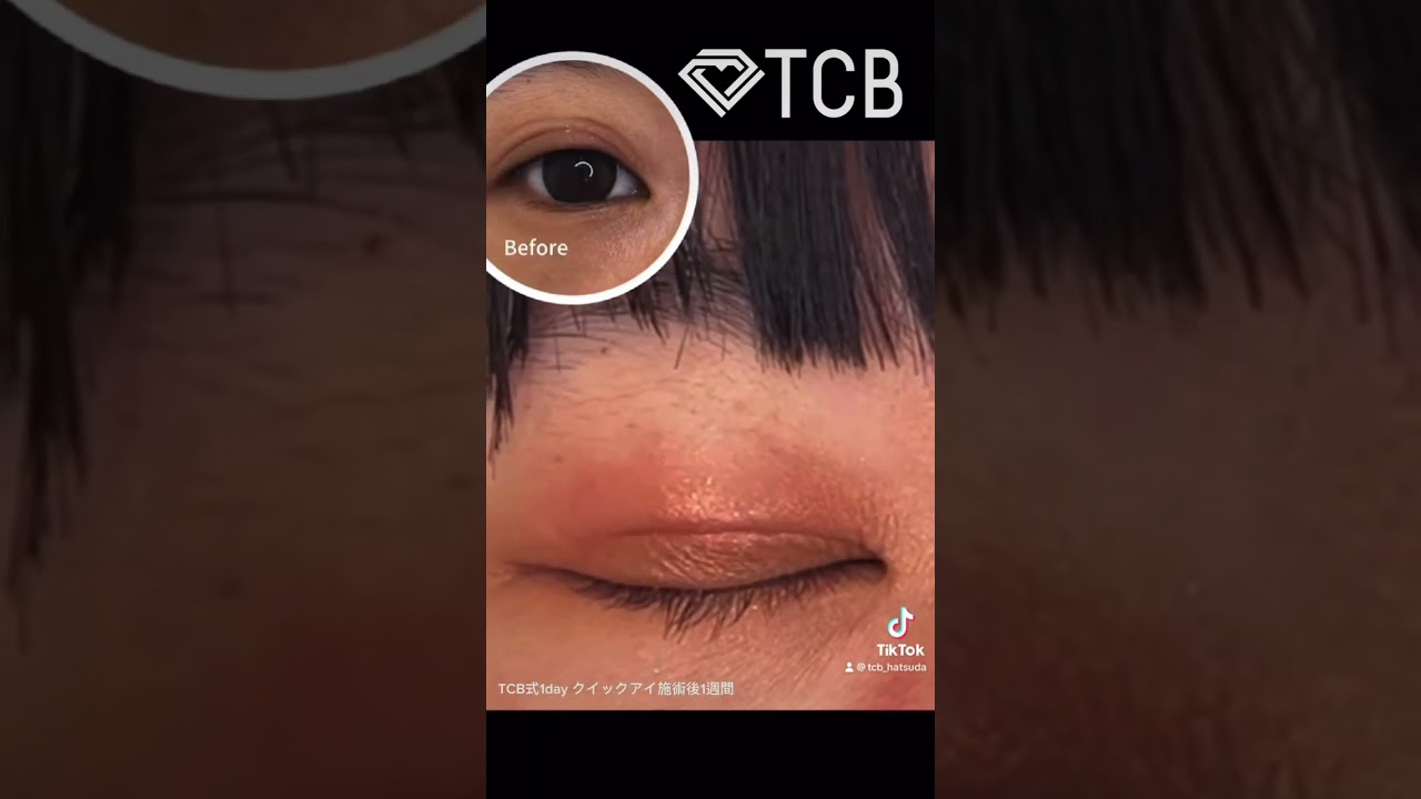 Youtubeのサムネイル