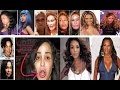 5 Expensive Celebrity Plastic Surgeries
