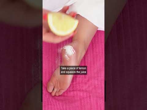 Dry skin on feet disappeared