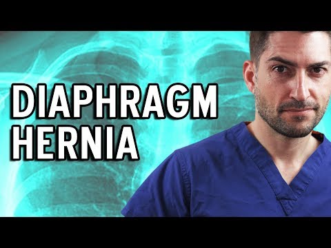 download lagu mp3 mp4 Broken Diaphragm, download mp3 Broken Diaphragm free downloadn, video klip Broken Diaphragm